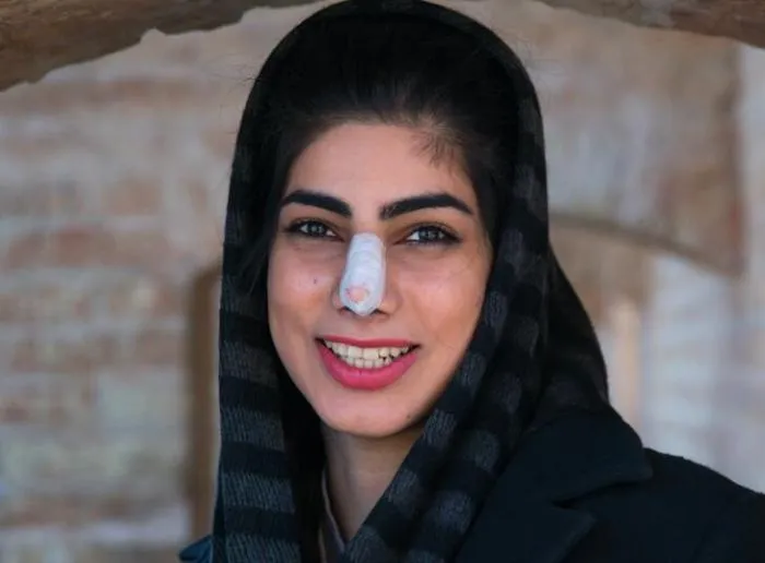 Почему у многих иранских девушек перебинтованы носы