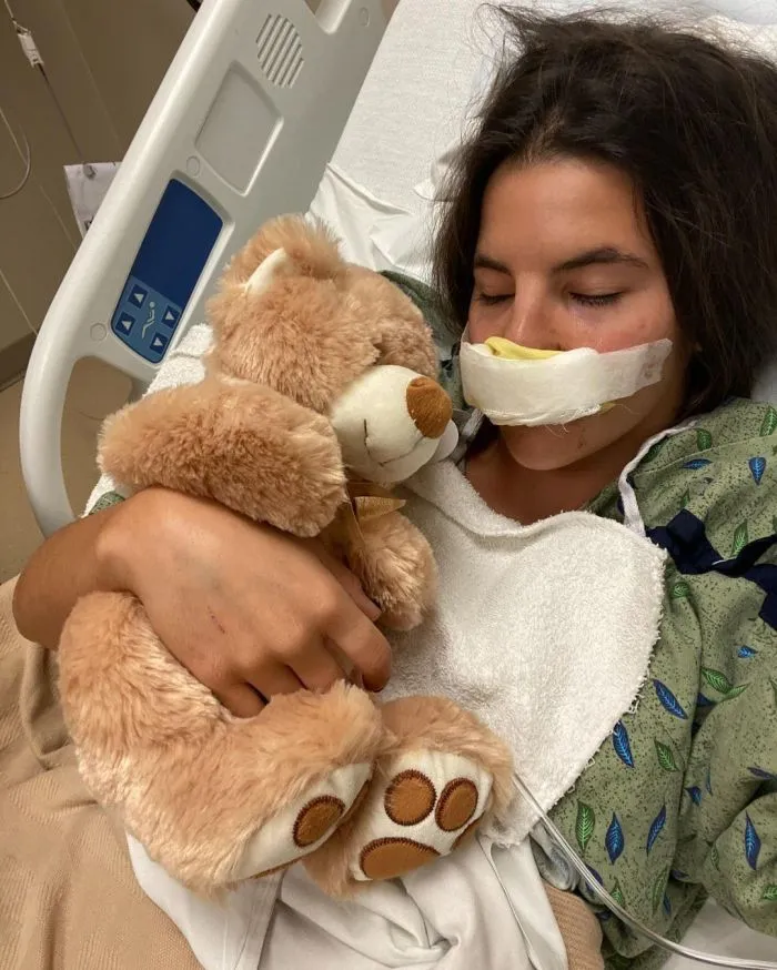 Встреча с питбулем навсегда изменила жизнь девушки, лишив её верхней губы