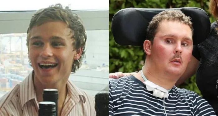 Съел живого слизня и стал овощем