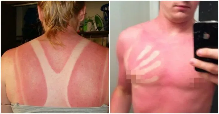 Бедолаги, которых "наказало" солнце