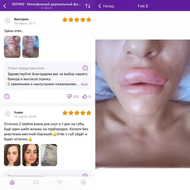 «Иглы толстоваты» Или как бабы себе в домашних условиях губы иголками увеличивают