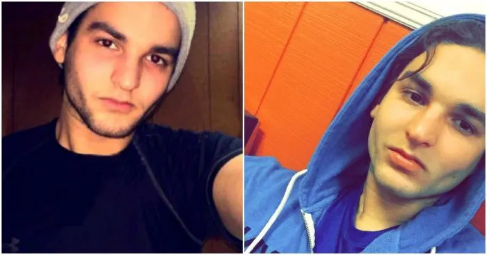 Машина, в которой ехал парень, загорелась - и он получил ожоги 80% тела, но сумел выжить и найти любовь