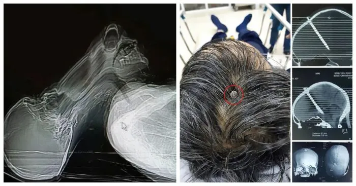 20 невероятных случаев из медицинской практики