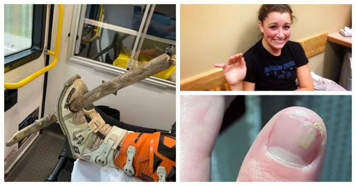 45 снимков, на которые больно смотреть