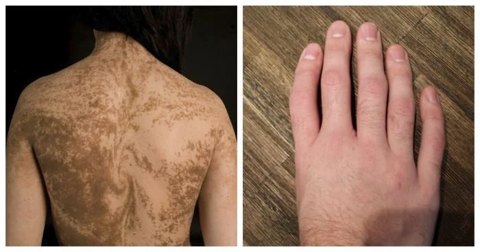 От природы: 35 людей с удивительными генетическими особенностями