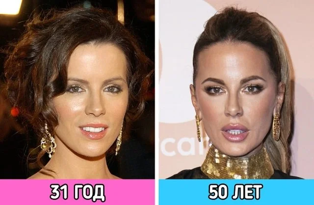 Вечно молодые: знаменитости, отказавшиеся стареть