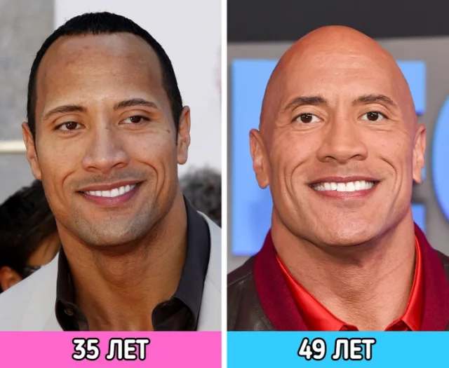 Вечно молодые: знаменитости, отказавшиеся стареть