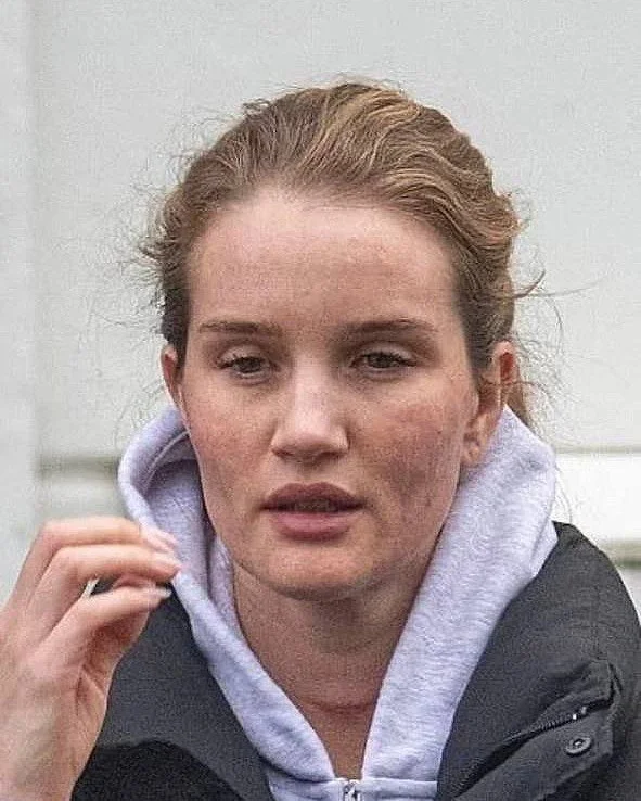 Фото Роузи Хантингтон-Уайтли с прыщами и естественной кожей