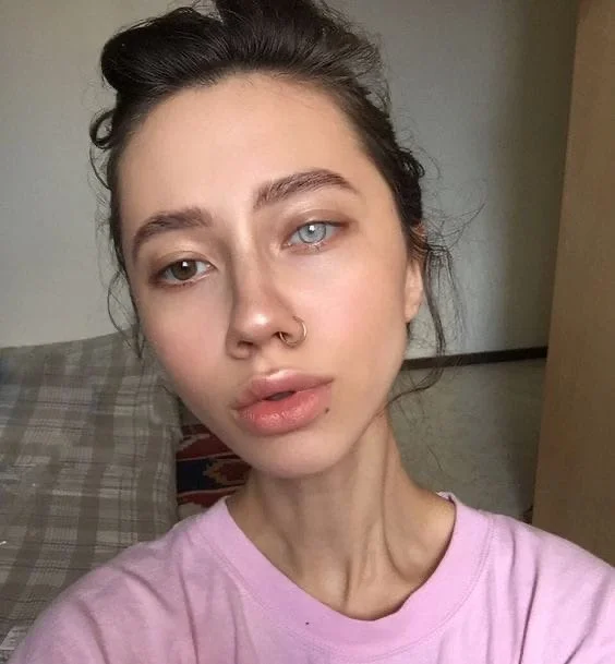 Гетерохромия