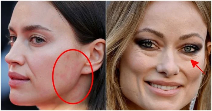 Под прицелом объектива: истинный облик кожи знаменитостей