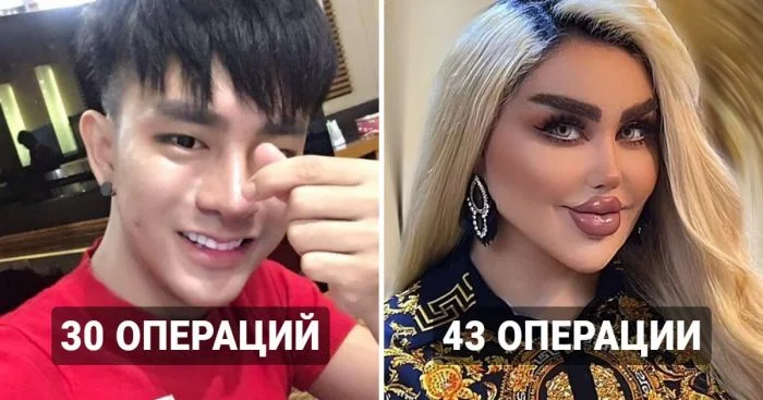Рекордсмены по числу операций в стремлении к идеальному внешнему облику