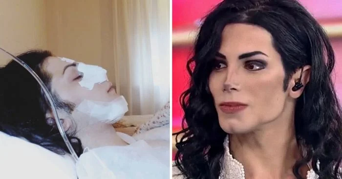 Рекордсмены по числу операций в стремлении к идеальному внешнему облику