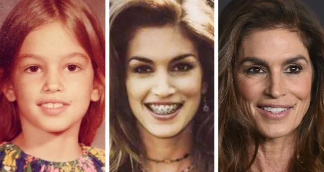 Улыбки в работе: Знаменитости, которые выбрали брекеты