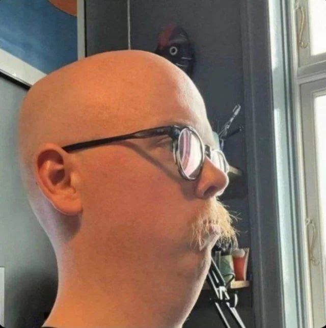 Превращение после бритья: история парня, который стал похож на червя