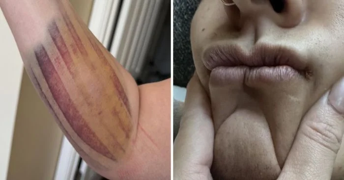 Удивительные особенности: 13 фотографий людей, которые привлекают внимание