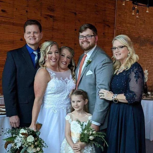 Врачи дали ответ на вопрос о близнецах Хенсел