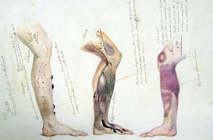 Сицилийский парадокс: история болезни моряков и её связь с преступной империей