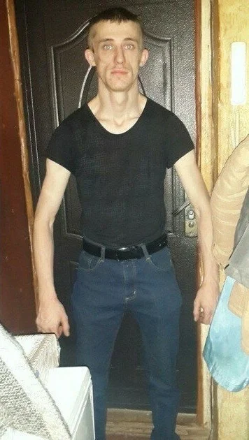 Синдром широкой спины⁠⁠