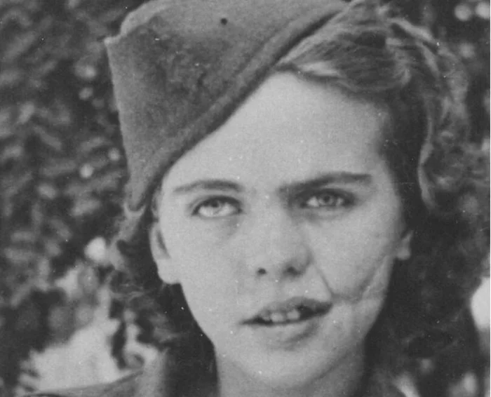 Война оставляет шрамы