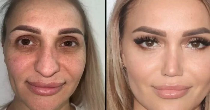 Изумительная работа пластического хирурга произвела фурор в соцсетях