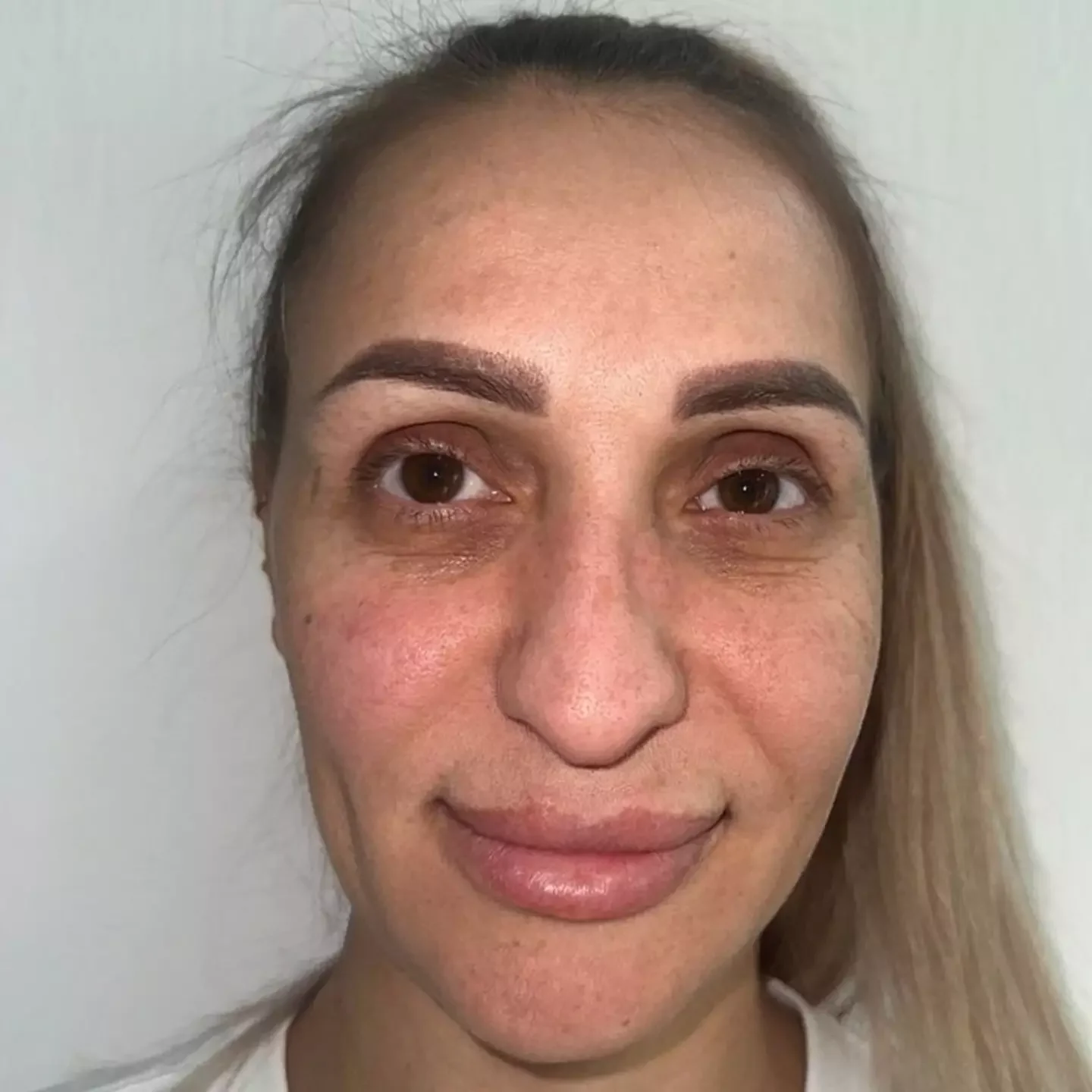 Изумительная работа пластического хирурга произвела фурор в соцсетях