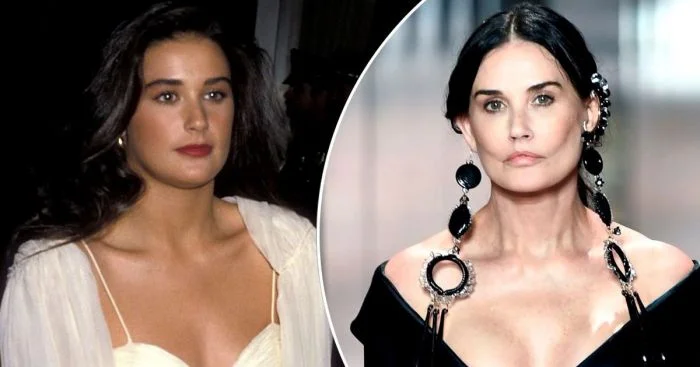 Звезды, чьи пухлые щеки трансформировались в изящные скулы