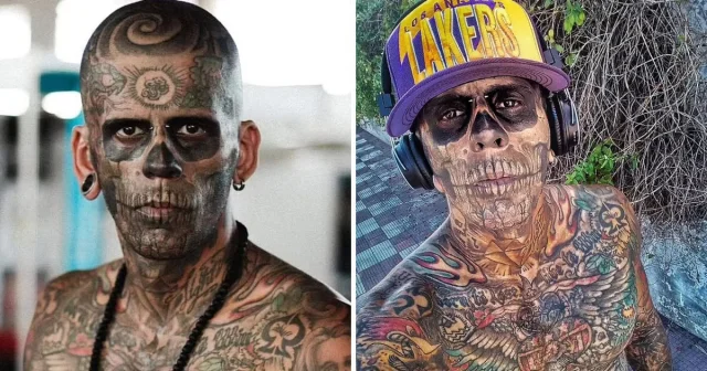 Леандро де Соуза, самый татуированный мужчина в Бразилии, начал удалять свои татуировки