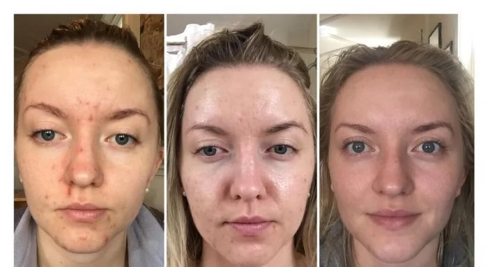 15 людей, которые стали лучшей версией самих себя