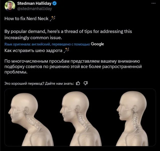 Как убрать 'шею ботаника': полезный гайд