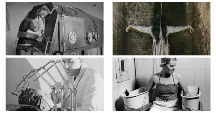 Пугающая медицина прошлого: редкие архивные снимки