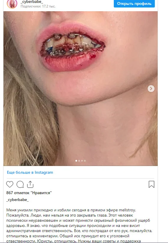 Популярный блогер избил девушку головой об стол