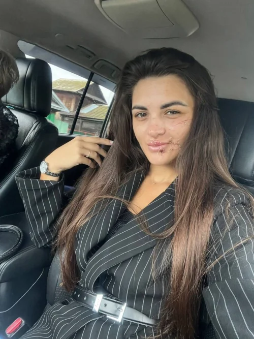 Неадекватный мужик разбил стакан об лицо женщины