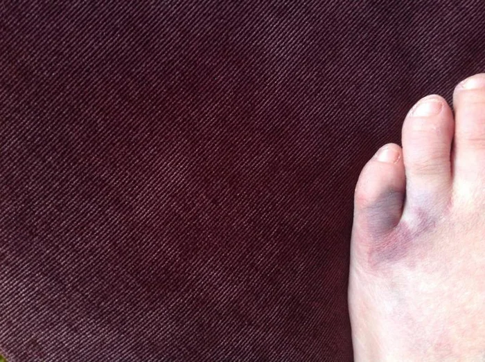 Для чего толстые женщины носят шпильки?