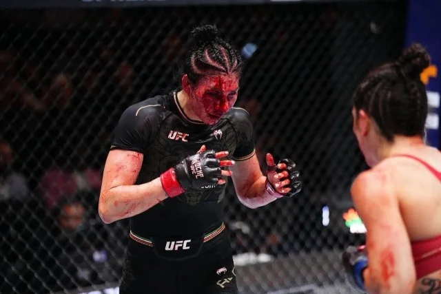 Бой UFC: Норма Дюмонт Виана и её разрушительный удар по лицу Ирэн Алданы