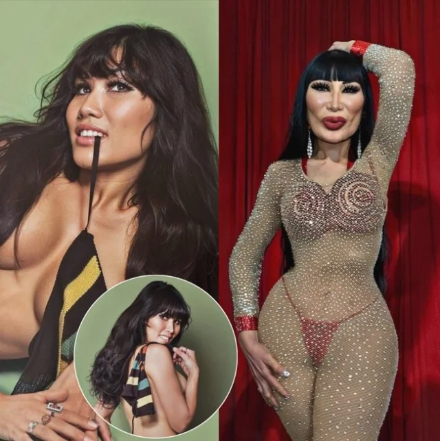 Пугачева, Михайлов и другие: странная мода на «надутые» лица