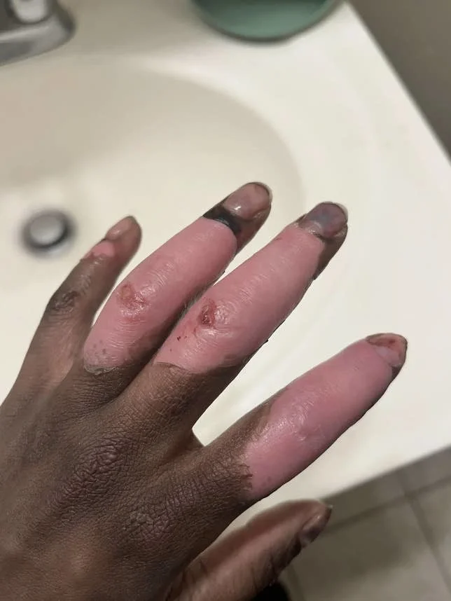 Удивительные и страшные аномалии человеческого тела