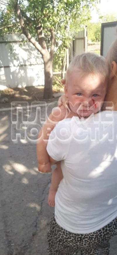 Бродячая собака в Краснодаре укусила младенца: её стерилизовали и выпустили обратно на улицы