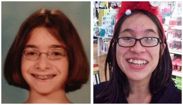 Чудесные трансформации: «гадкие утята», превратившиеся в красавцев