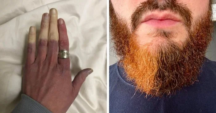 Матушка-природа постаралась: 16 людей с особенными чертами