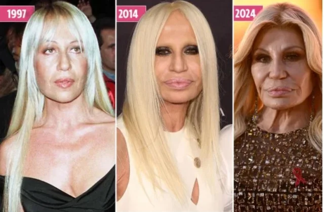 Донателла Версаче вновь поработала над своим лицом