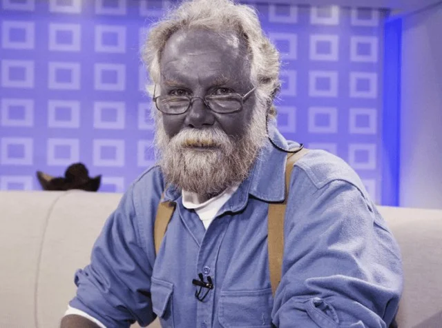 Как попытка укрепить здоровье сделала Пола Карасона «синим человеком»