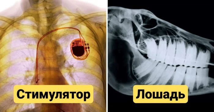 Рентгеновские изображения, показывающие привычное с новой стороны