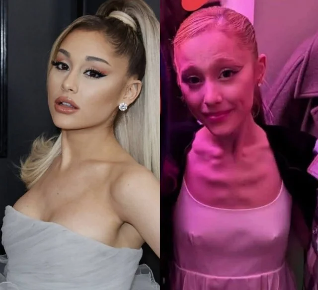 Фанаты встревожены из-за худобы Арианы Гранде