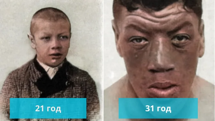 Адам Райнер: трагедия карлика, ставшего гигантом