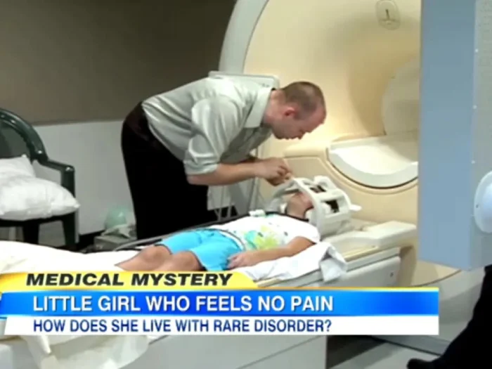 Люди, которые не чувствуют боль: как редкое заболевание влияет на их жизнь