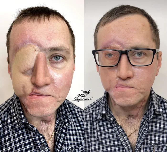 Глаз, который изменил всё: медицинское чудо и художественный эксперимент