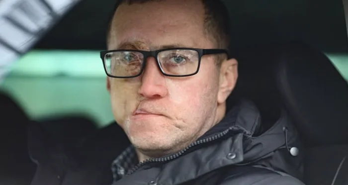 Глаз, который изменил всё: медицинское чудо и художественный эксперимент