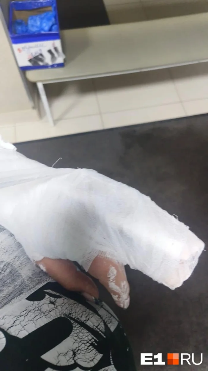 За неделю в России произошло уже третье нападение собак