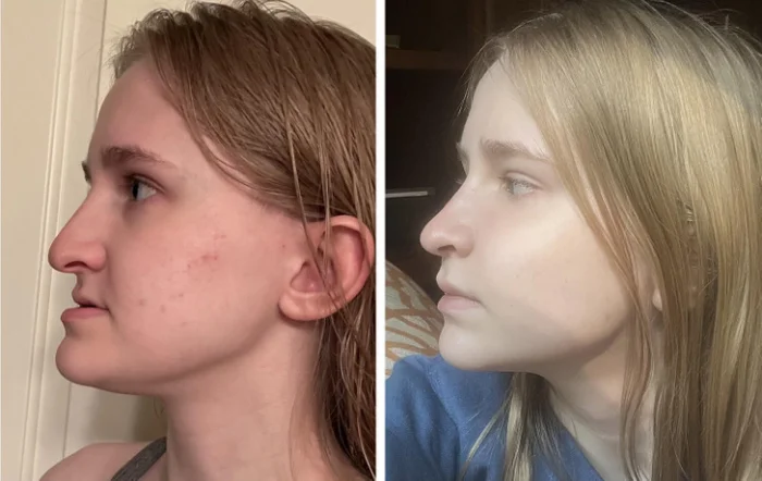 14 снимков с такой очевидной разницей, что её заметит даже малыш