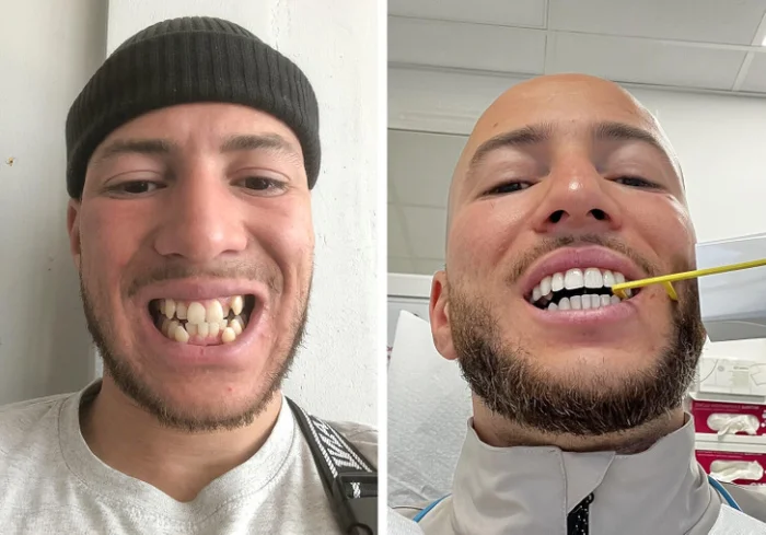 Фото, где разница настолько очевидна, что её заметит даже ребёнок